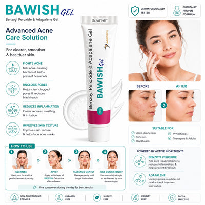 Dr. Awish BAWISH Gel – Advanced Acne Solution with Benzoyl Peroxide & Adapalene